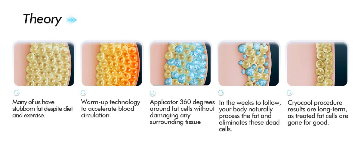 Freeze Machine Cryolipolysis Freezing Fat Freeze Machine Cryolipolysis Freezing Fat